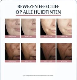 Eucerin Anti-Pigment Spotcorrector - Concealer - 5 Ml -Cosmetica Winkel 1157x1200 1