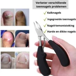 Merkloos Nageltang Voor Harde Teennagels - Manicureset Teennagelknipper - Teennagelschaar - Pedicure Set 9 Merkloos Nageltang Voor Harde Teennagels - Manicureset Teennagelknipper - Teennagelschaar - Pedicure Set -Cosmetica Winkel 1196x1200 40