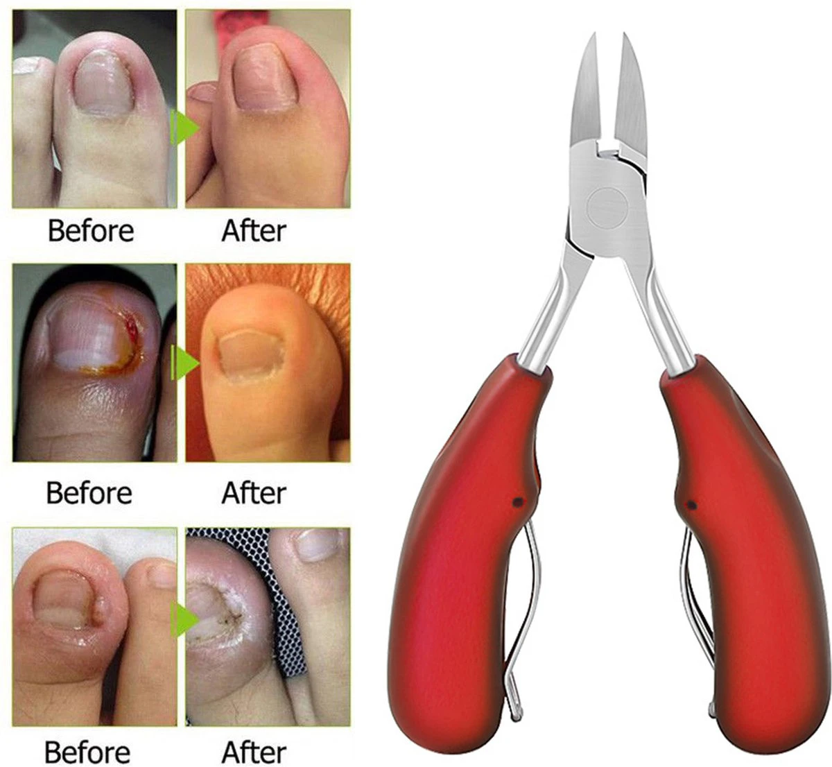 IGOODS Nagelriem Knipper - Professionele Teennagelknipper Cutter Tang - RVS - Zwart - Dikke Nagels Tool Gesneden Nagel - Teen Trimmer 8 IGOODS Nagelriem Knipper - Professionele Teennagelknipper Cutter Tang - RVS - Zwart - Dikke Nagels Tool Gesneden Nagel - Teen Trimmer - Afbeelding 8
