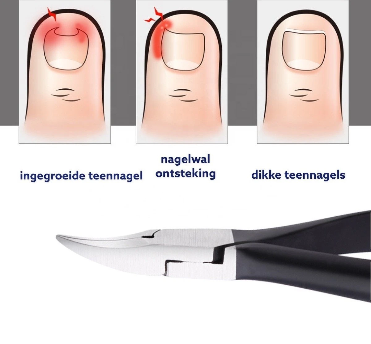 Medies - Professionele Zware Nageltang Voor Teennagels | Nagelknipper Teennagels | Ingegroeide Teennagel | Kalknagel | Harde Teennagels | Nagelschaar | Pedicure - Ingebouwde Veren 6 Medies - Professionele Zware Nageltang Voor Teennagels | Nagelknipper Teennagels | Ingegroeide Teennagel | Kalknagel | Harde Teennagels | Nagelschaar | Pedicure - Ingebouwde Veren - Afbeelding 6