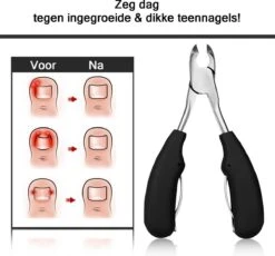 Merkloos Nageltang Met Gebogen Bek + Vijl - Nagelknipper Set - Pedicure Set 12 Merkloos Nageltang Met Gebogen Bek + Vijl - Nagelknipper Set - Pedicure Set -Cosmetica Winkel 1200x1117 13