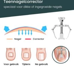 7-Delige Pedicure Set - Nagelverzorging - Nagelset Starterset - Ingegroeide Teennagel - Kalknagelproducten - Pedicuresets - RVS 15 7-Delige Pedicure Set - Nagelverzorging - Nagelset Starterset - Ingegroeide Teennagel - Kalknagelproducten - Pedicuresets - RVS -Cosmetica Winkel 1200x1130 27