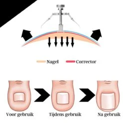 Merkloos STARMAN 7-delige Pedicure En Manicure Set - Nagelknipper - Pedicureset - Nagelvijl - Nageltang - Kalknagel - Teennagelknipper 14 Merkloos STARMAN 7-delige Pedicure En Manicure Set - Nagelknipper - Pedicureset - Nagelvijl - Nageltang - Kalknagel - Teennagelknipper -Cosmetica Winkel 1200x1200 2221