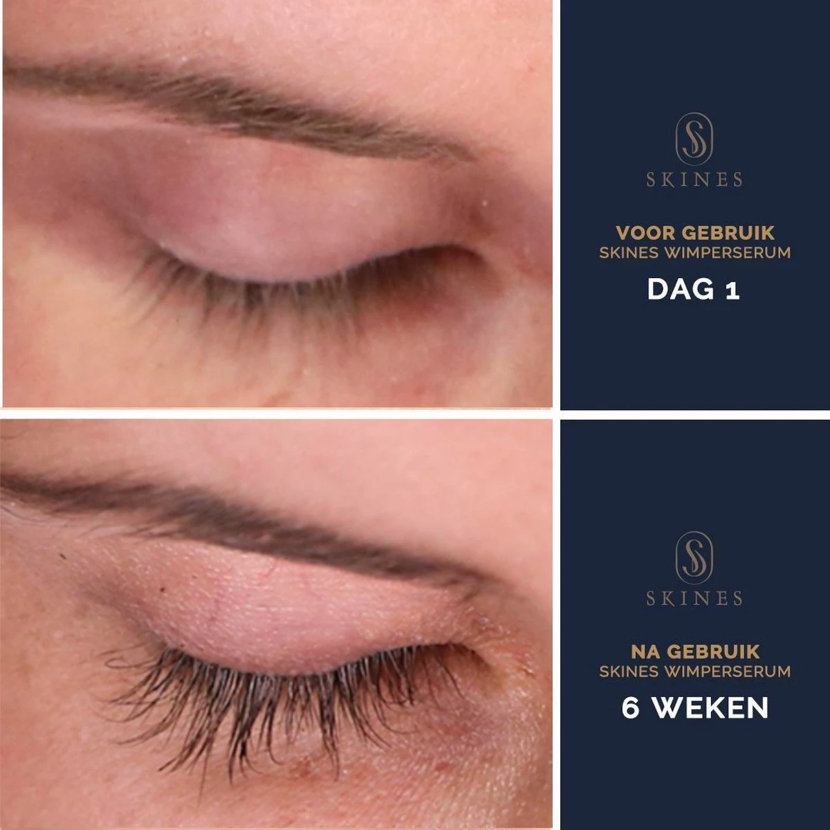 Skines® Wimperserum Premium – Eyelash Serum - Wenkbrauw Serum - Wimper Groei - 3ML 5 Skines® Wimperserum Premium – Eyelash Serum - Wenkbrauw Serum - Wimper Groei - 3ML - Afbeelding 5