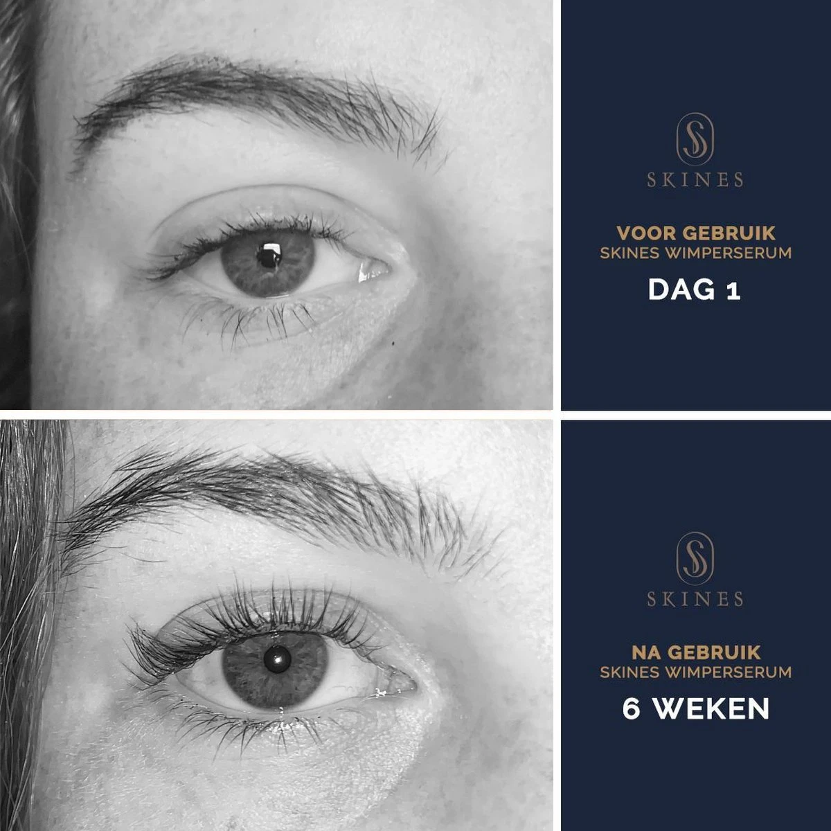 Skines® Wimperserum Premium – Eyelash Serum - Wenkbrauw Serum - Wimper Groei - 3ML 6 Skines® Wimperserum Premium – Eyelash Serum - Wenkbrauw Serum - Wimper Groei - 3ML - Afbeelding 6