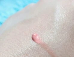 Biodermal Sun Lipbalm SPF25 - Tube 12 Ml - Natural Pink - Lippenbalsem 7 Biodermal Sun Lipbalm SPF25 - Tube 12 Ml - Natural Pink - Lippenbalsem -Cosmetica Winkel 1200x927